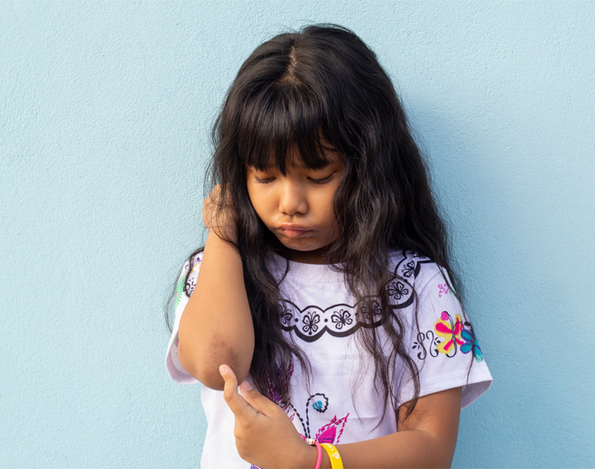 Young girl holding injured arm