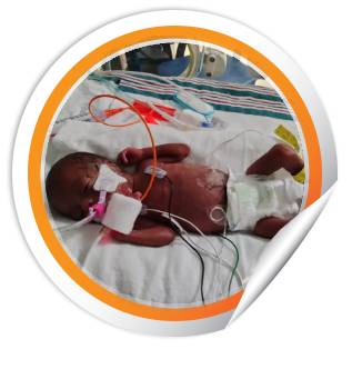 nicu-baby