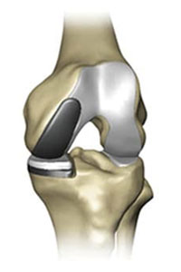 medial-200x300