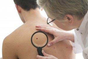 Doctor examining skin spot