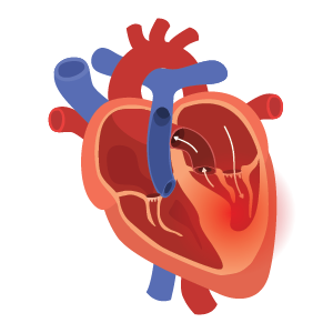 PBHN-BRND-Web Content Update-Structural Heart-DIG-WEB-300x300-2026_02
