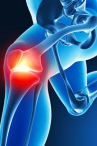 Illustration of knee pain