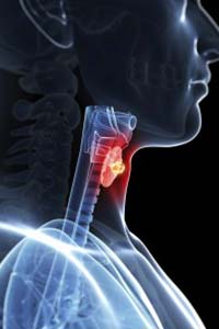 X-ray view of throat