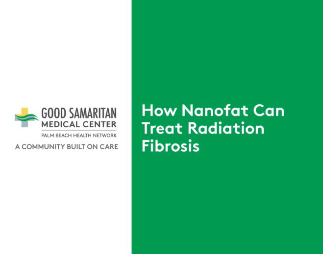 nanofat-659x519
